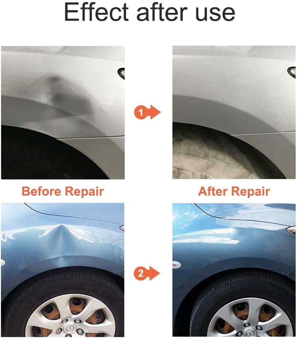 Dent Repair Kit for Cars E9519